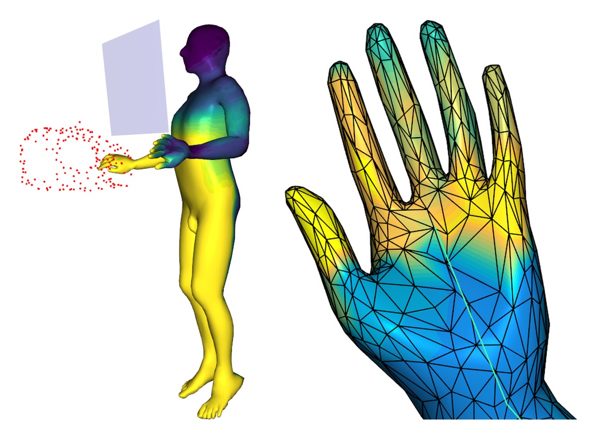 Computed dose distribution on the operator’s body and a close-up of the hand, coloured from low to high dose.