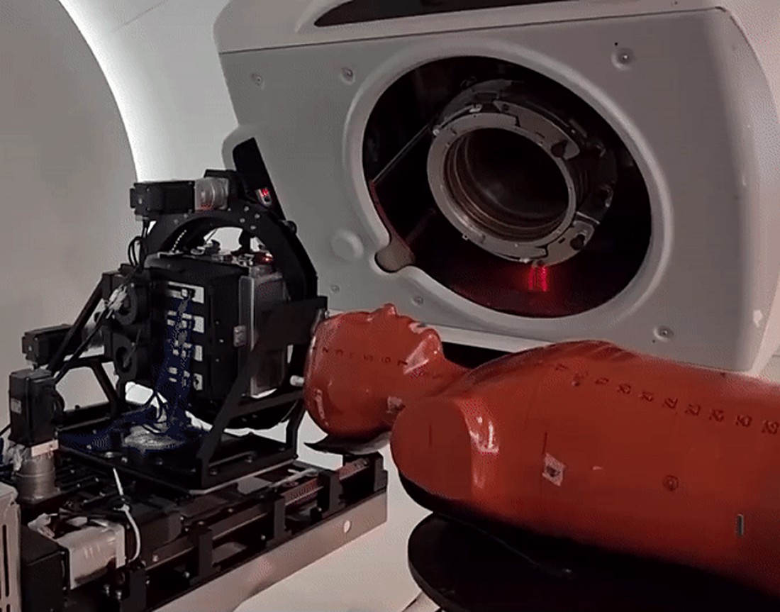 The prompt gamma camera beside a human phantom on the treatment couch, facing the beam nozzle of a proton therapy gantry.